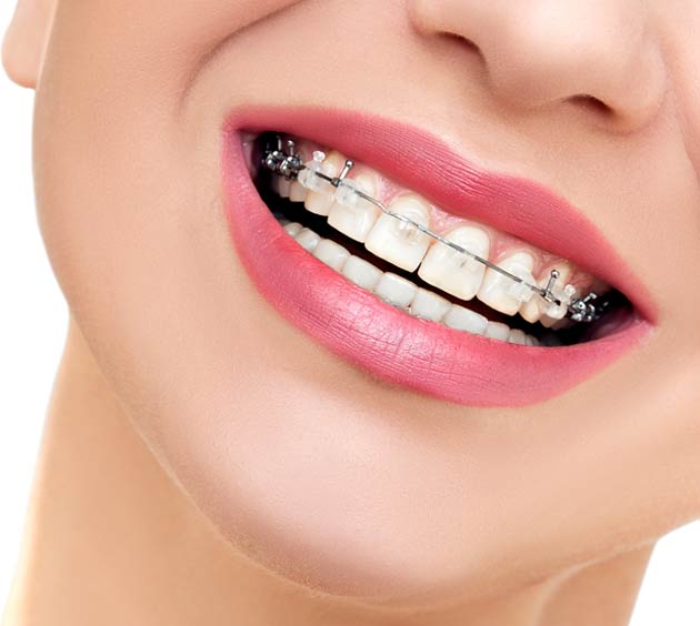 Orthodontics